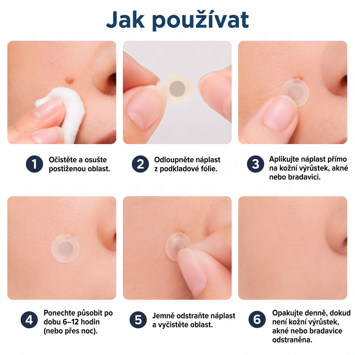 ✅✅ Oficiální obchod | MURWON® 🌥️ Botanická mikrojehličková hydrokoloidní náplast (Na kožní výrůstky, malé kožní útvary, bradavice, mateřská znaménka, věkové skvrny a pigmentové skvrny)💙