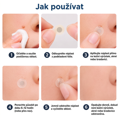 ✅✅ Oficiální obchod | MURWON® 🌥️ Botanická mikrojehličková hydrokoloidní náplast (Na kožní výrůstky, malé kožní útvary, bradavice, mateřská znaménka, věkové skvrny a pigmentové skvrny)❤️