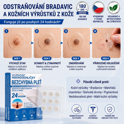 👩‍⚕️💯 Oficiální obchod | MURWON® 🌥️ Mikrojehličková náplast pro odstranění kožních nedokonalostí (Pro kožní výrůstky, drobné kožní útvary, bradavice, mateřská znaménka, stařecké skvrny a pigmentové nepravidelnosti.)💛