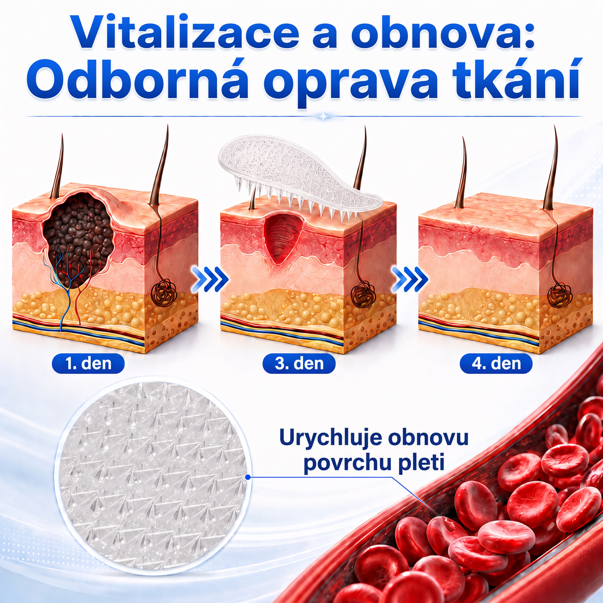 ✅✅ Oficiální obchod | MURWON® 🌥️ Botanická mikrojehličková hydrokoloidní náplast (Na kožní výrůstky, malé kožní útvary, bradavice, mateřská znaménka, věkové skvrny a pigmentové skvrny)❤️