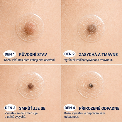 Oficiální přímý prodej | ✨MURWON® 💕 Mikrojehličková náplast pro odstranění kožních nedokonalostí (Pro kožní výrůstky, drobné kožní útvary, bradavice, mateřská znaménka, stařecké skvrny a pigmentové nepravidelnosti.)
