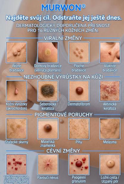 👩‍⚕️💯 Oficiální obchod | MURWON® 🌥️ Mikrojehličková náplast pro odstranění kožních nedokonalostí (Pro kožní výrůstky, drobné kožní útvary, bradavice, mateřská znaménka, stařecké skvrny a pigmentové nepravidelnosti.)💛