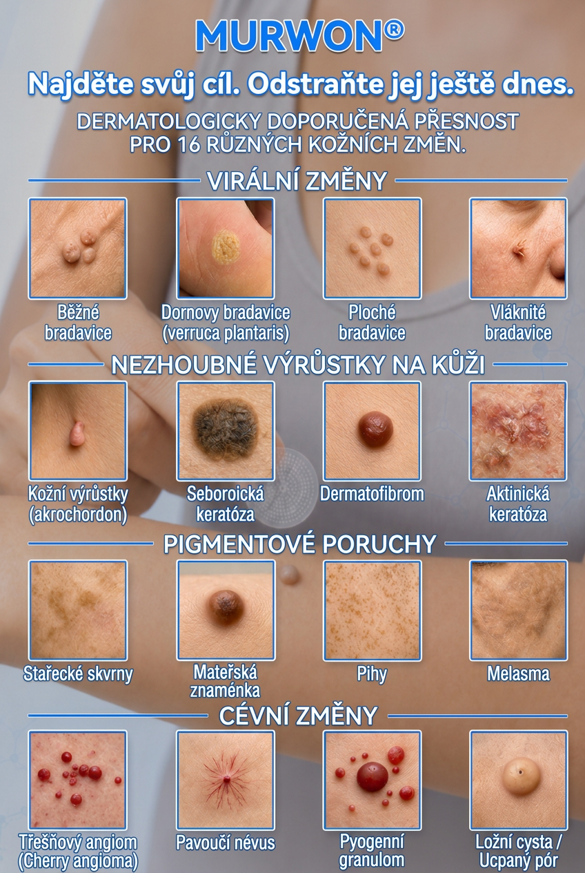 👩‍⚕️💯 Oficiální obchod | MURWON® 🌥️ Mikrojehličková náplast pro odstranění kožních nedokonalostí (Pro kožní výrůstky, drobné kožní útvary, bradavice, mateřská znaménka, stařecké skvrny a pigmentové nepravidelnosti.)🖤