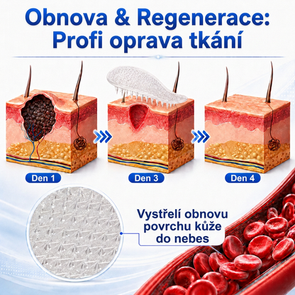 Oficiální přímý prodej | ✨MURWON® 💕 Mikrojehličková náplast pro odstranění kožních nedokonalostí (Pro kožní výrůstky, drobné kožní útvary, bradavice, mateřská znaménka, stařecké skvrny a pigmentové nepravidelnosti.)